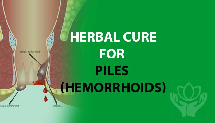 Best herbal treatment for Hemorrhoids