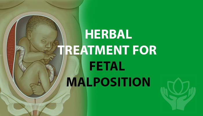 Herbal medicine for Fetal Malpresentation