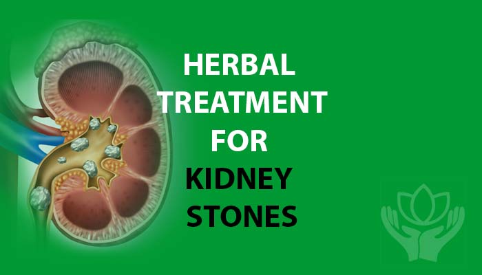Herbal Treatment for Kidney Stones